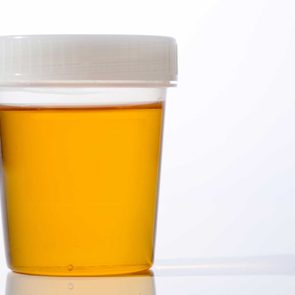 pee health liver disease