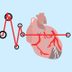 This Infographic Shows What a Heart Attack Looks Like Depending on Your Race and Gender