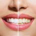 Yellow Teeth Are Actually Stronger Than Bright White Teethâ€”Hereâ€™s Why