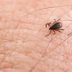 10 Things to Do Right Now If You've Been Bitten By a Tick