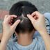 14 Expert Tips for How to Get Rid of Head Lice