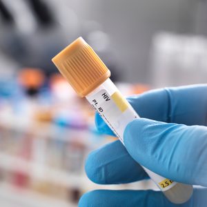 Medical technician preparing a human sample for HIV testing