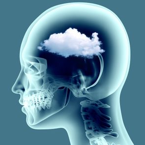 x ray image of human brain with cloud detail