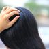 Is It Scalp Psoriasis or Dandruff? Hereâ€™s How to Tell the Difference