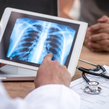 Doctor reading the scan lung on digital tablet screen.