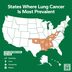 Lung Cancer Is Worst in These 8 States, New National Report Says